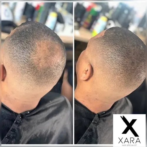 Fibres Capillaire marque Allemande- XARA