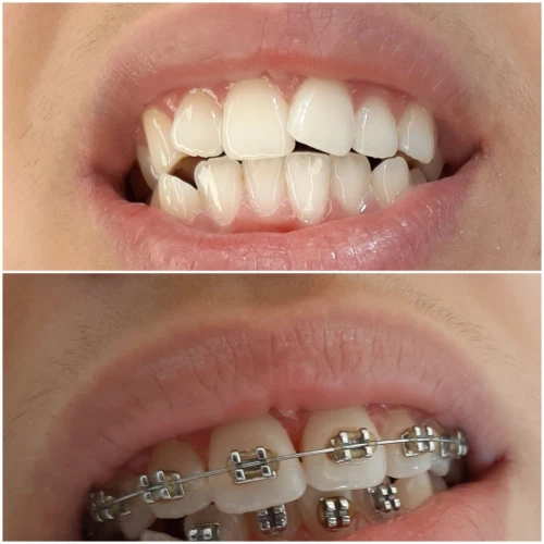 orthodontie ODF
