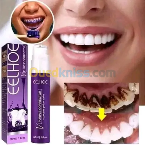 مبيض  للاسنان eelhoe