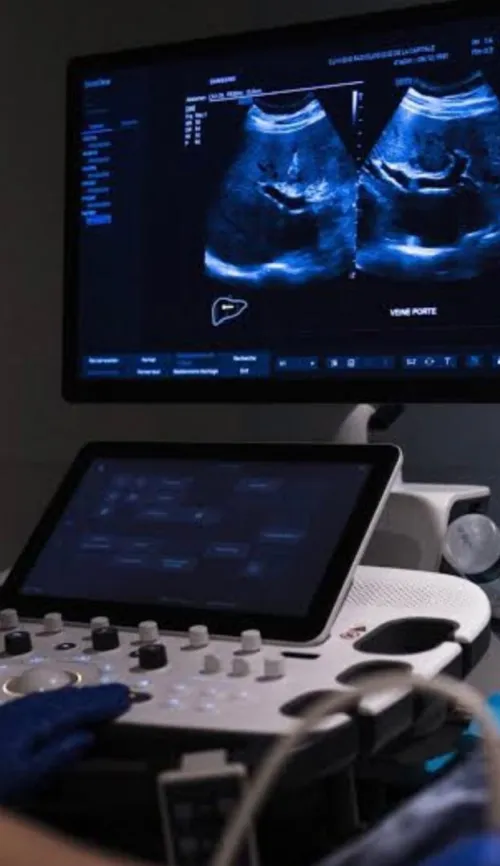 Cherche médecin radiologue femme pour remplacement 