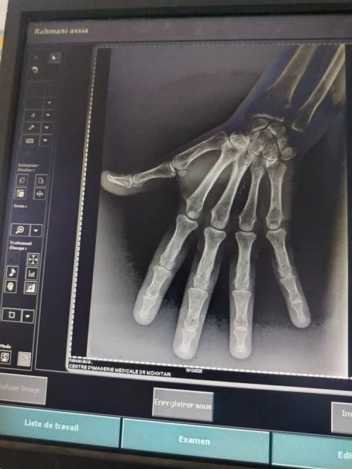 Radiographie mobile