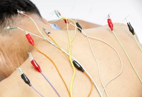 محفز كهربائي للإبر الصينية  Eléctrostimulateur d'acupuncture (Stimulateur)