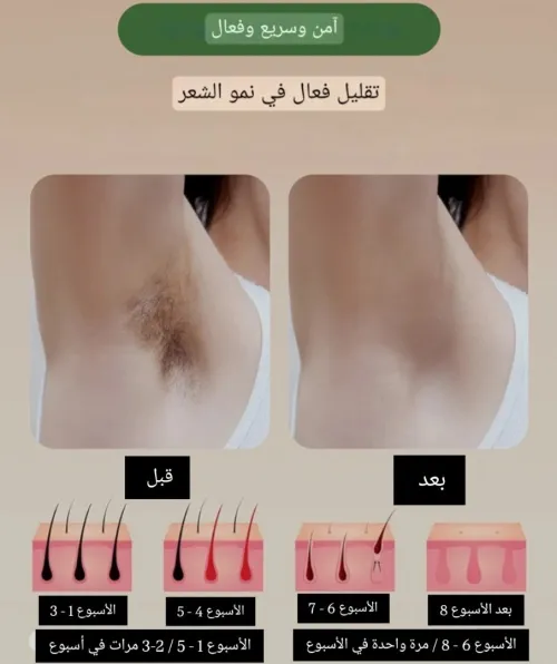 ipl pro original hair removal 1 million flashes