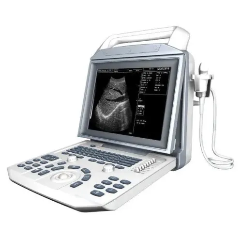 Échographe zonecare  mobile i50 avec deux sondes convexe et linaires
