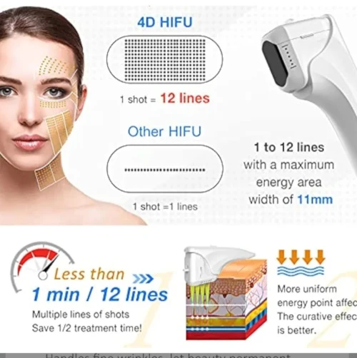 Hifu machine 5EN1