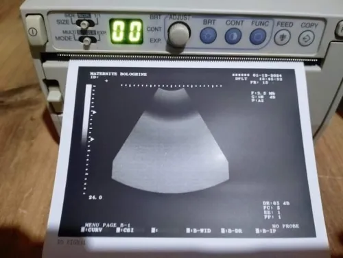 Imprimante thermique vidéo
