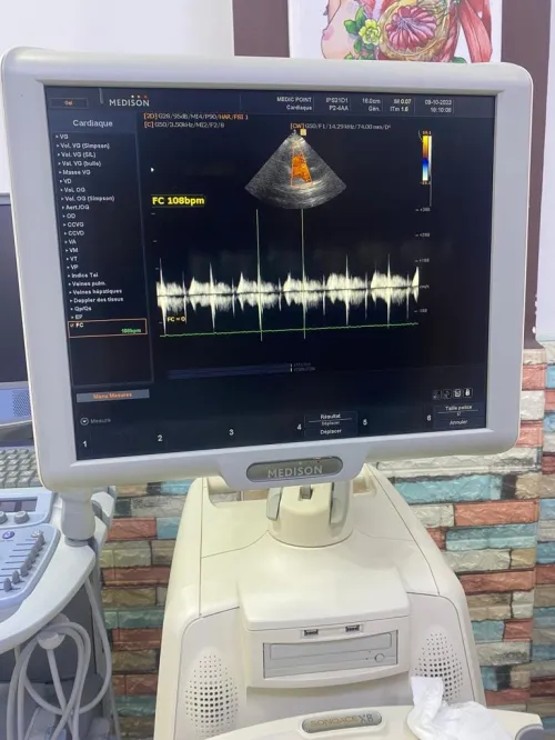 Échographe medison Sonoace X8 cardio