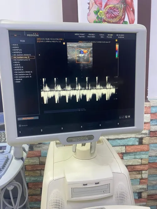 Échographe medison Sonoace X8 cardio