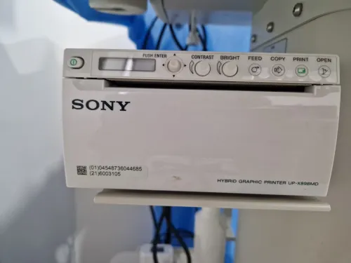 ECHOGRAPHE SONOSCAPE A6 portatif