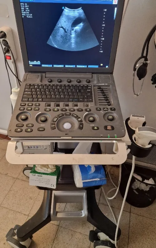 Échographe Doppler portable Sonoscape S8 Expert