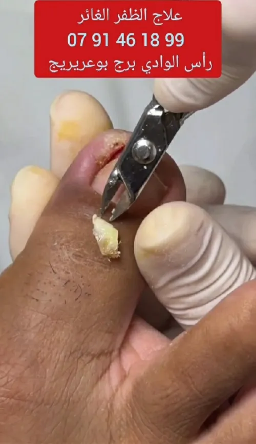 Podologie & petite chirurgie dermatologique