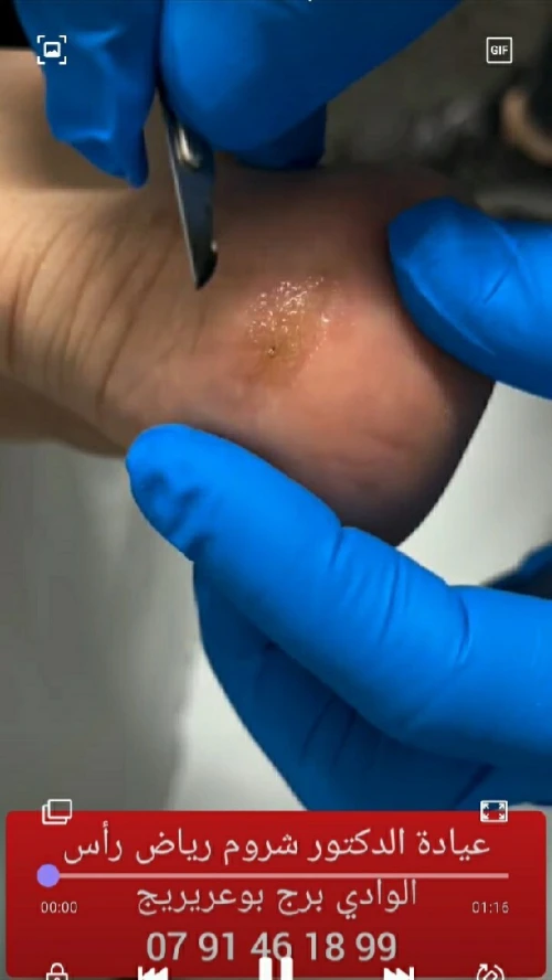 Podologie & petite chirurgie dermatologique