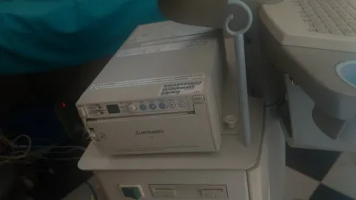 Échographie doppler 