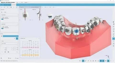 Maestro 3D Dental Studio V6