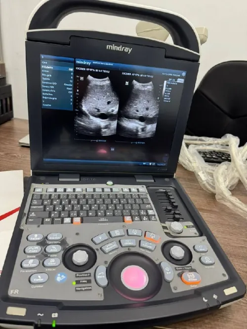 Echographe portatife mindray dp 10