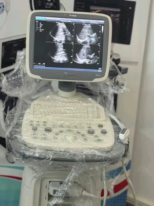 Echographe sonoscap s11
