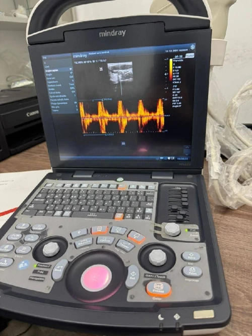 Echographe portatife mindray dp 10