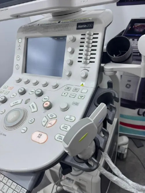 Echographe toshiba xario 200