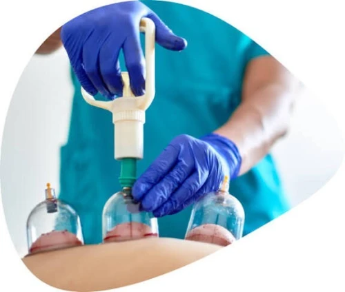 Hijama je me déplace