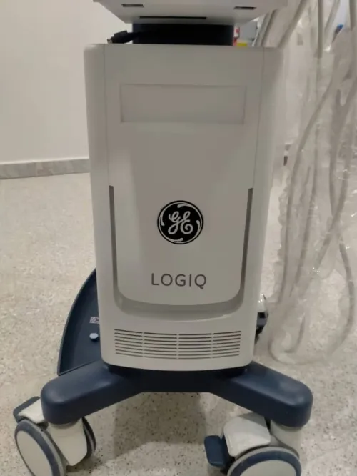 Échographie Général Électric GE LOGIQ