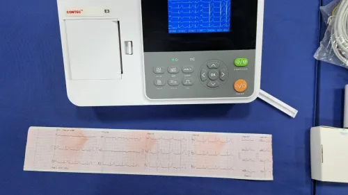 Electrocardiographe ECG Contec E3 (3 pistes) avec interprétation (Nouveau modèle)