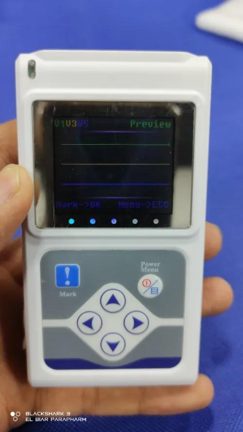 Holter ECG 3 Dérivations 24 H TLC9803 CONTEC