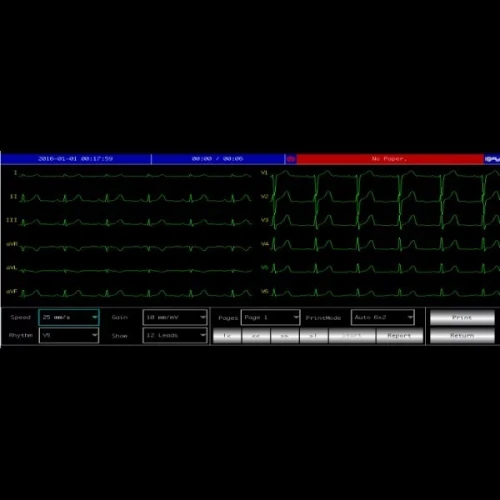 Electrocardiographe ECG Contec 600G (6 pistes) avec interprétation