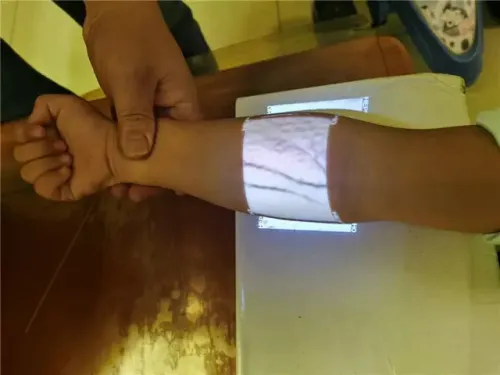  Détecteur de veines professionnel كاشف الاوردة طبي