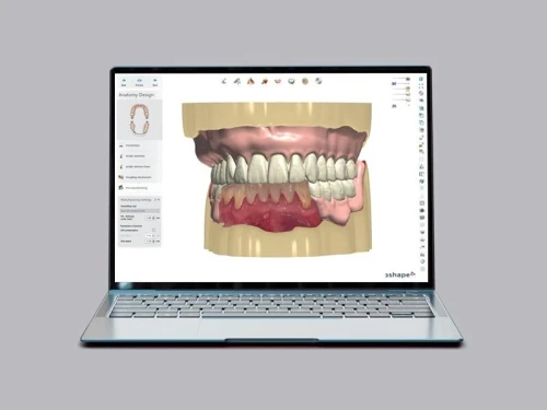 3Shape Dental System