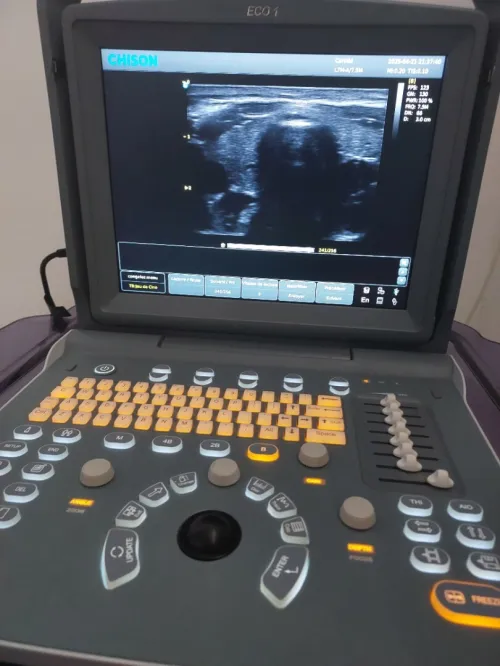 Echographe