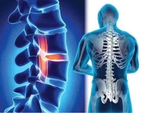 Chiropratique الكيروبراكتيك