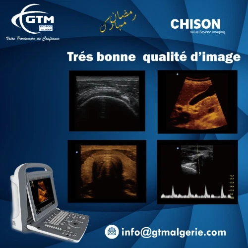 Echodoppler Couleur ECO 2