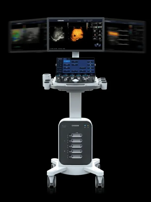 Echographe CHISON 