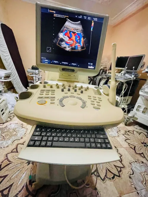 Echographe SONOACE MEDISON X8 