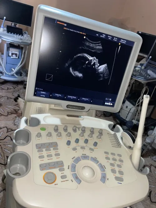 Echographe SONOACE MEDISON X8 
