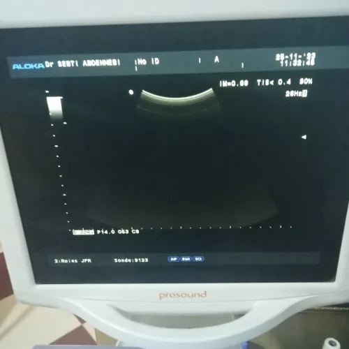 Echographe