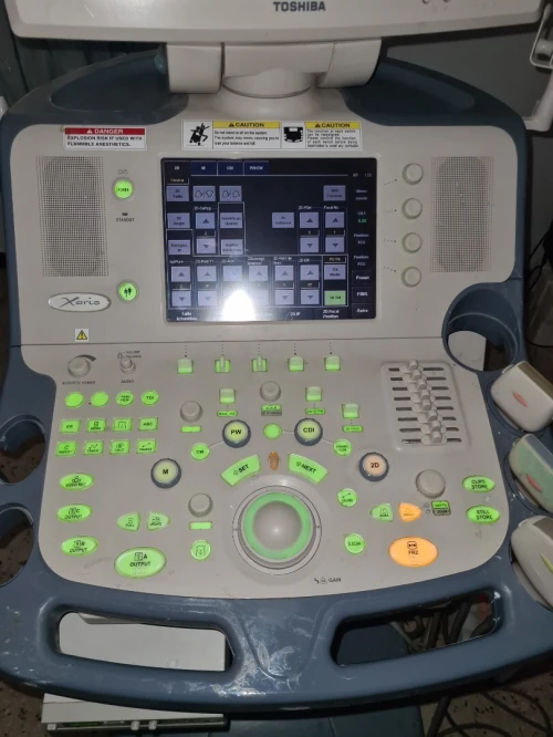 Échographe toshiba xario 