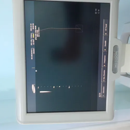 ECHOGRAPHE SONACE X6 MEDISON avec doppler