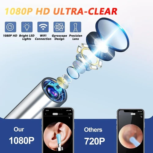 Nettoyeur visuel de cire d'oreille avec caméra, Endoscope d'élimination du cérumen en toute sécurité avec caméra de 5M, Otoscope lumineux, outils de nettoyage des oreilles, soins des oreilles