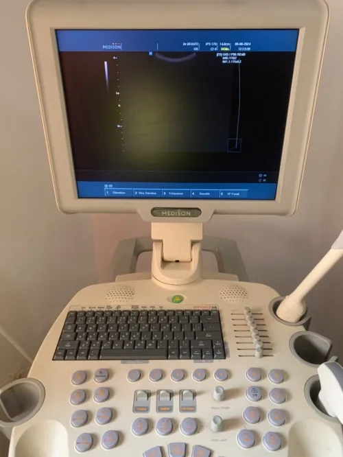 Échographie medison sonoace x6