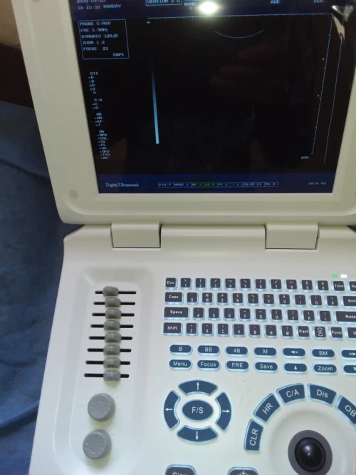 Echographe portatif 10 pouces neuf