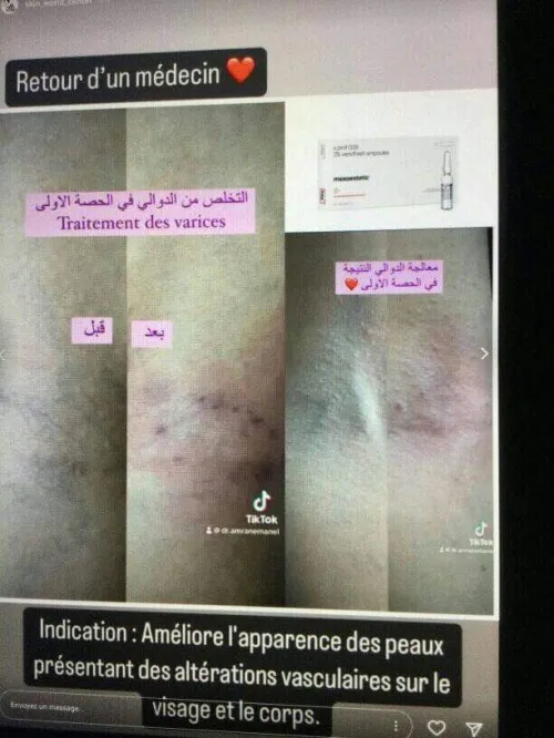 produits mesotherapie esthetique  dermo esthetique 