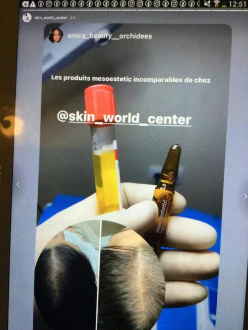 produits mesotherapie esthetique  dermo esthetique 