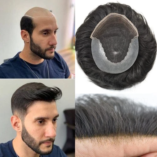 Prothèse capillaire homme  Australia /mono / pu