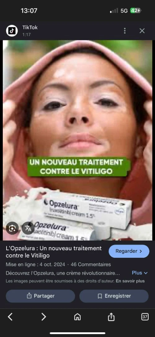 Crème pour le nouveau traitement de vitiligo