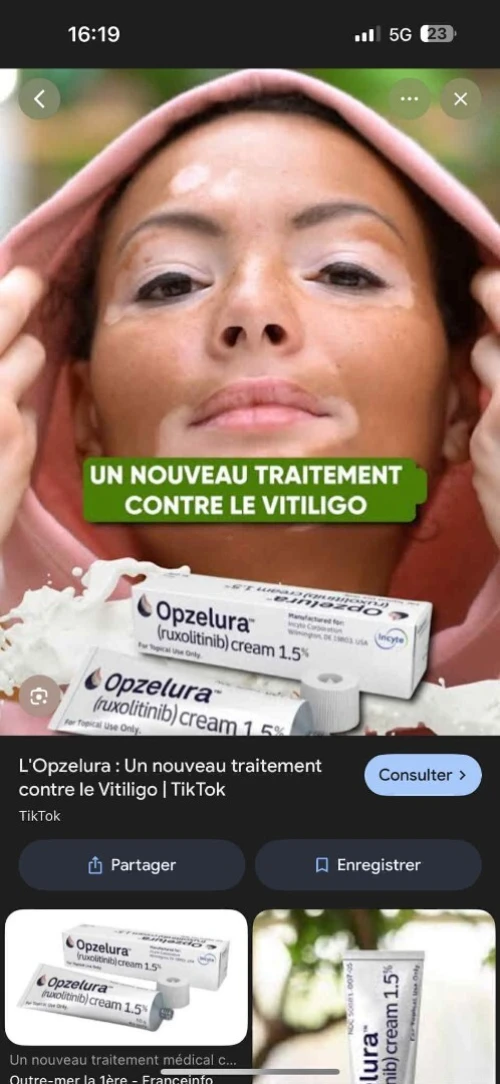 Crème pour le nouveau traitement de vitiligo
