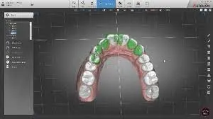 Autolign 3d Diorco 2022