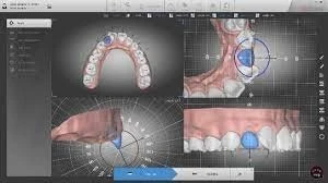 Autolign 3d Diorco 2022
