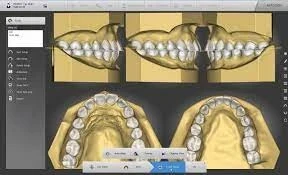 Autolign 3d Diorco 2022