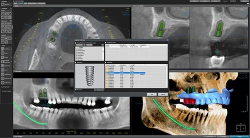 OnDemand3D Dental 2022